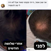 Revivex 2.0 - ערכה לטיפול ושיקום נשירת שיער והתקרחות