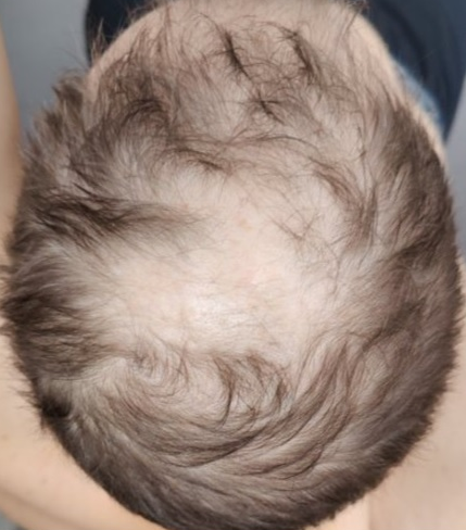 Before — יואב ל.