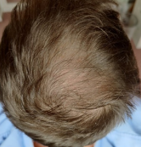 After — יואב ל.