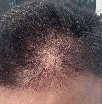 Before — דור מ.