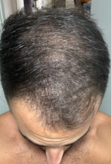 Before — שחר ה.