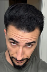 After — שחר ה.