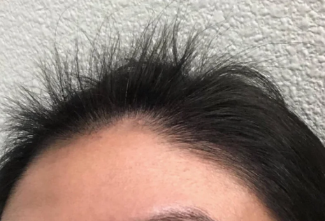 Before — שרון ב.