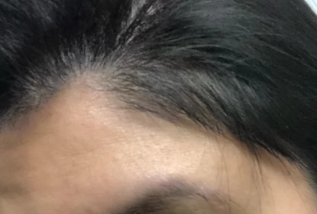 After — שרון ב.