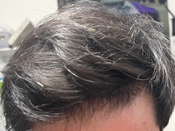 After — ברק ש.