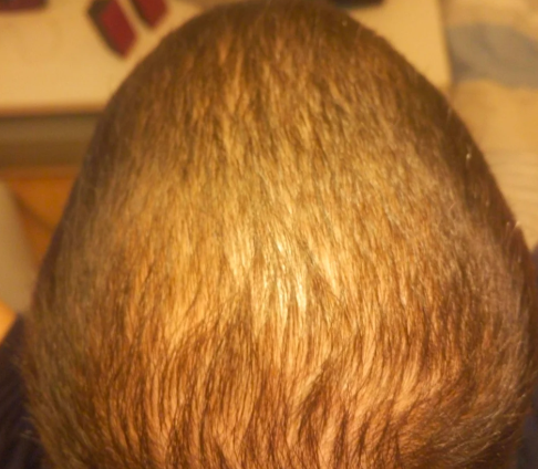 Before — יונתן י.