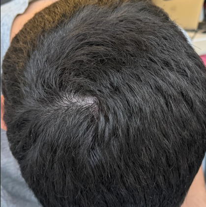 After — יונתן י.