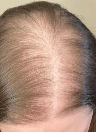 Before — אסף ר.