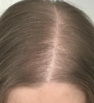 After — אסף ר.