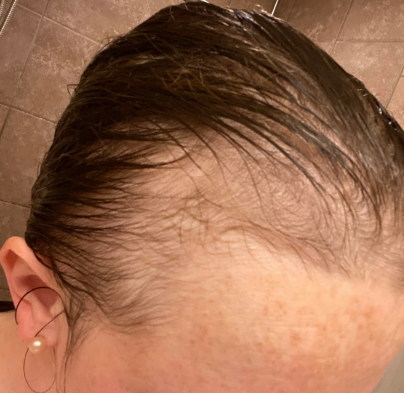 Before — רוני א.