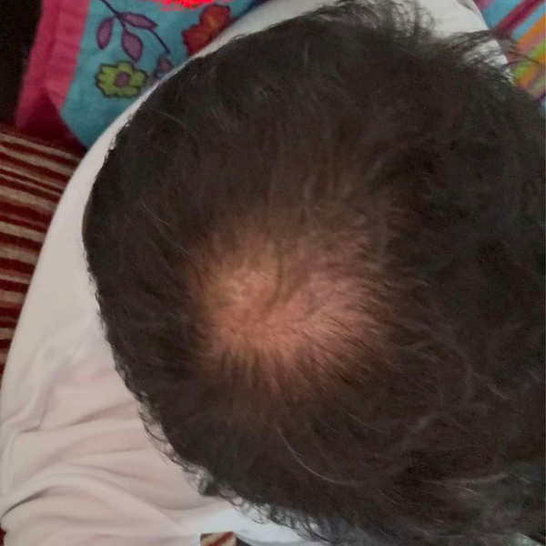 Before — אורי ק.