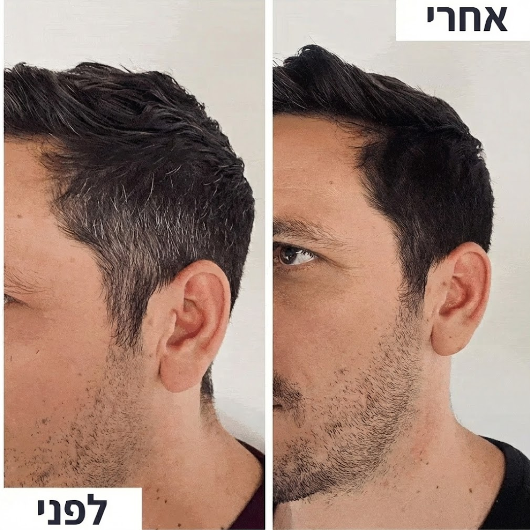 AntiGray - פתרון מתקדם לטיפול בשיער לבן