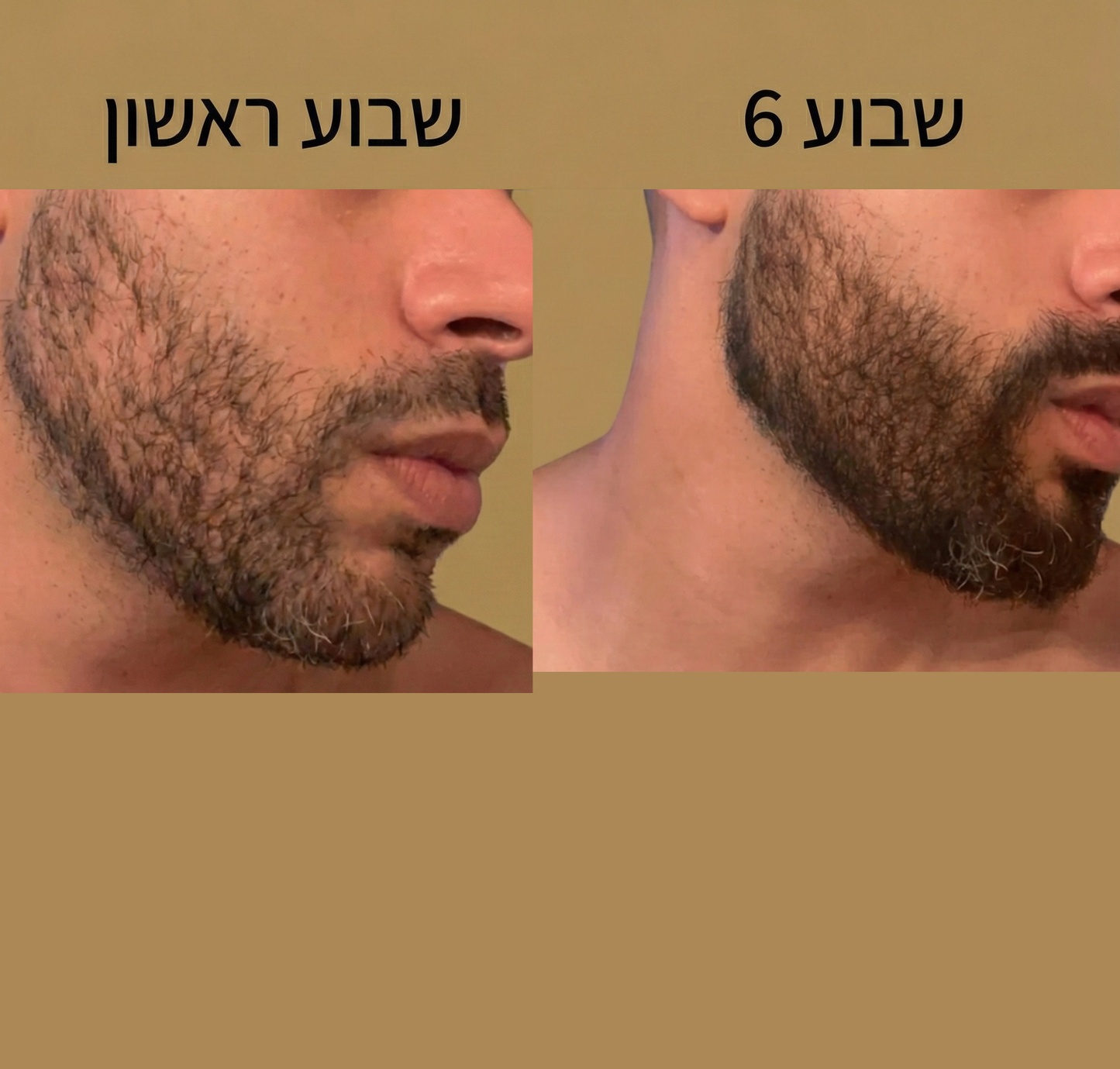 Revivex Beard - ערכה לטיפול וצמיחת זקן