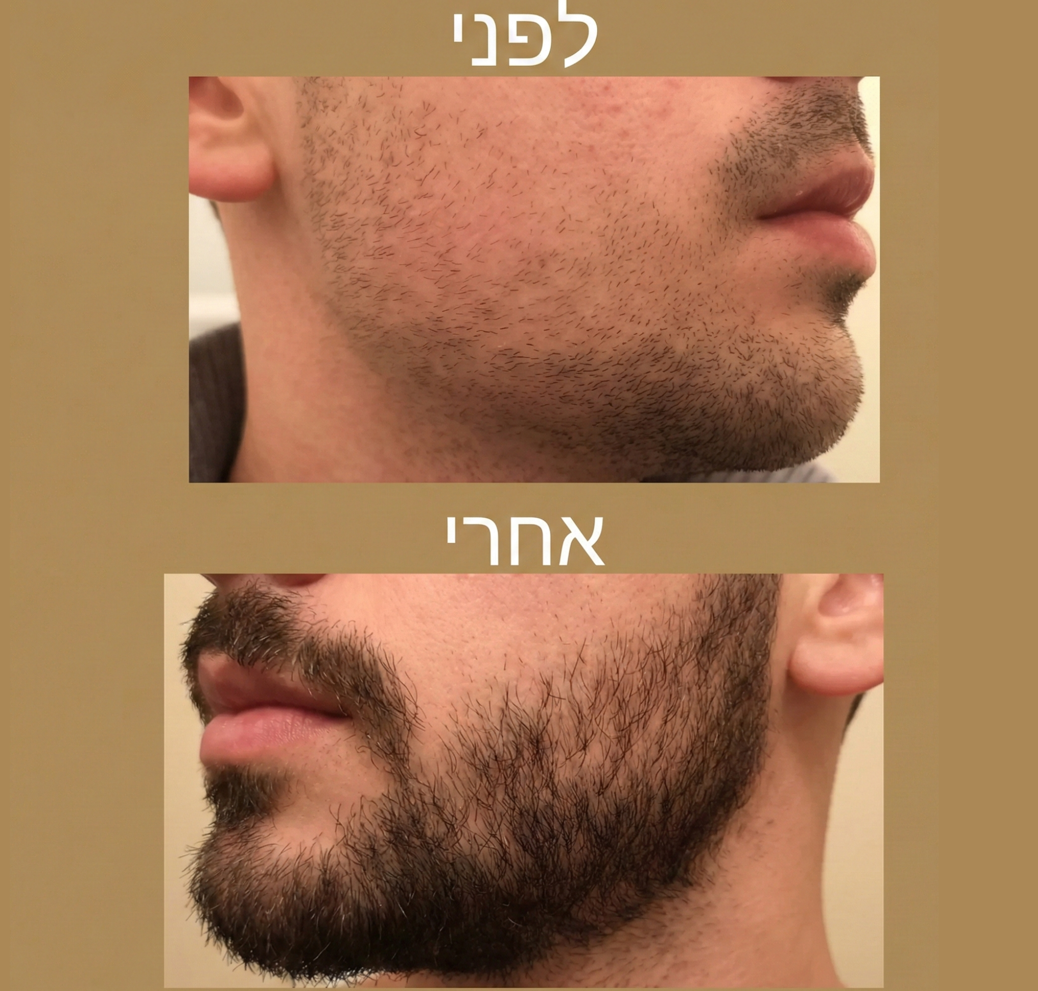 Revivex Beard - ערכה לטיפול וצמיחת זקן