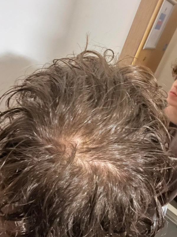 Before — ניר א.