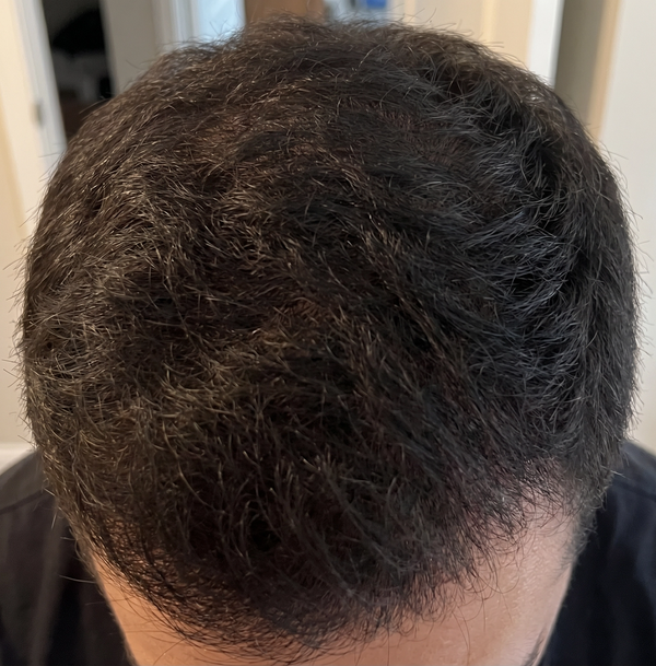 After — דור מ.