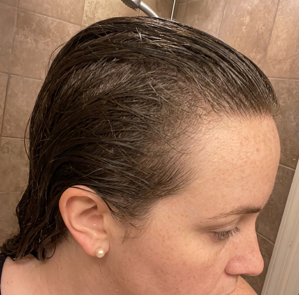 After — רוני א.