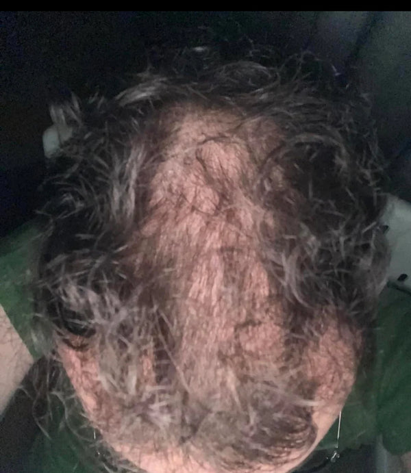 Before — עמית פ.