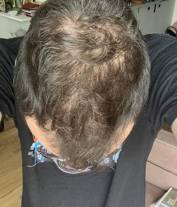 After — עמית פ.