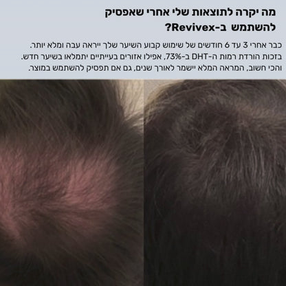 Revivex™ - ערכה לטיפול ושיקום נשירת שיער
